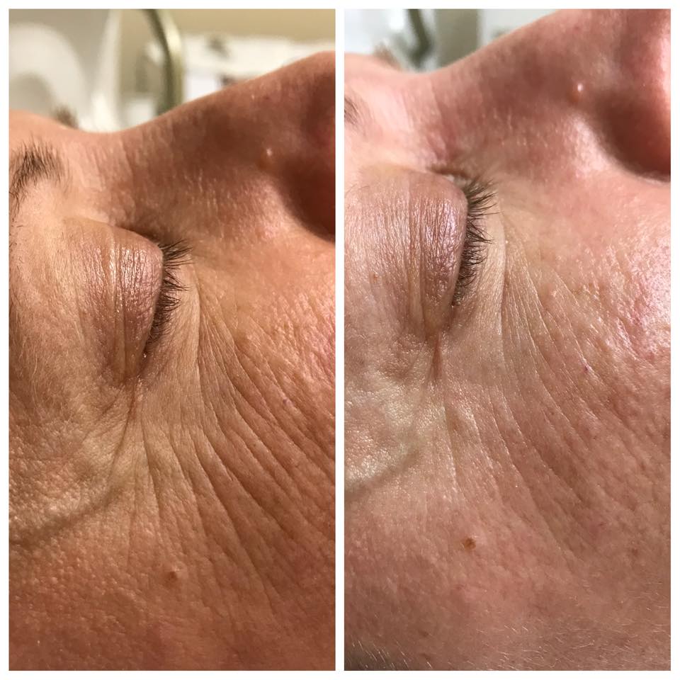 biolifting 3.0