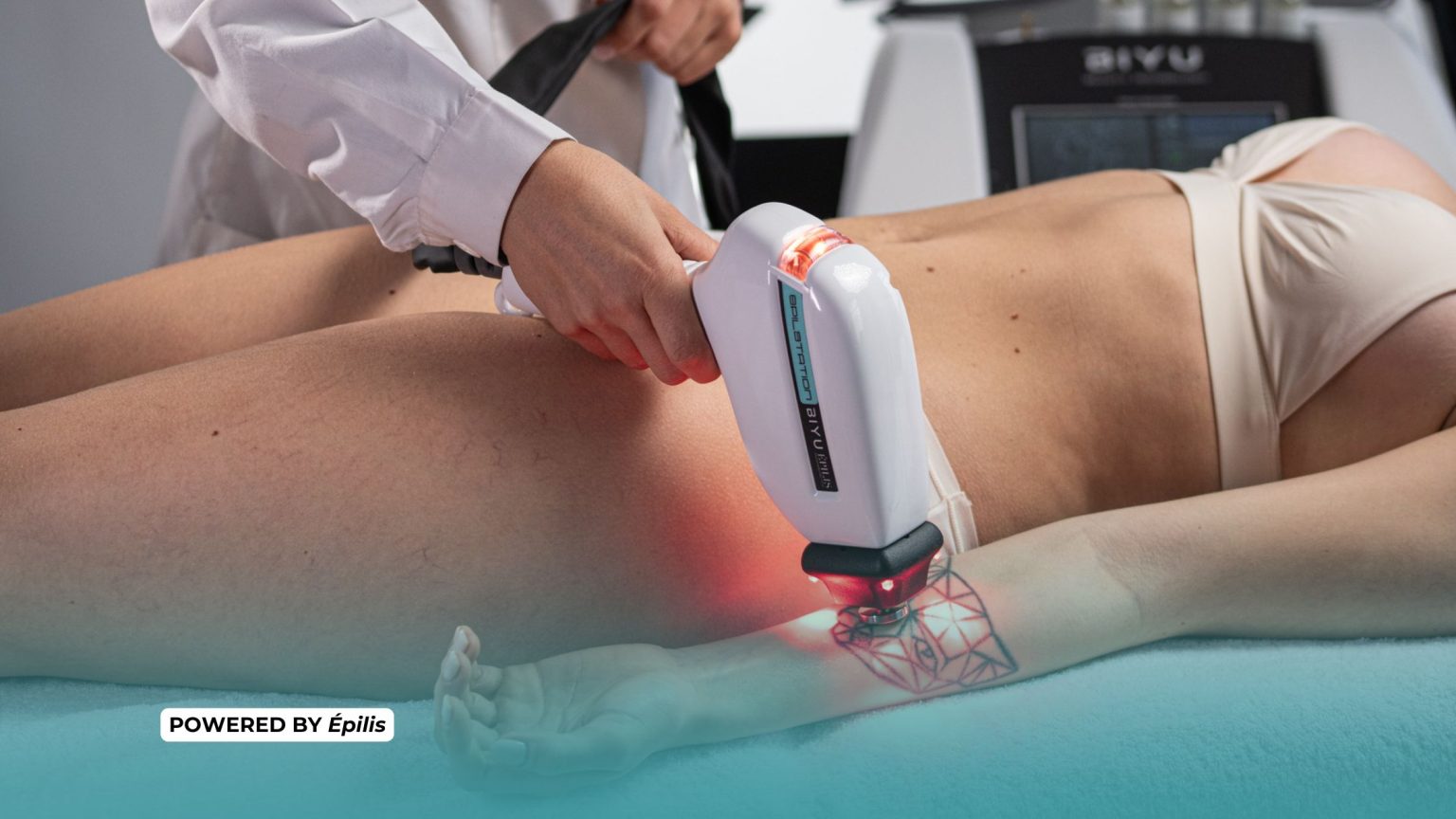 in foto una cliente che si sta sottoponendo a epilazione progressiva permanente e potenza del laser