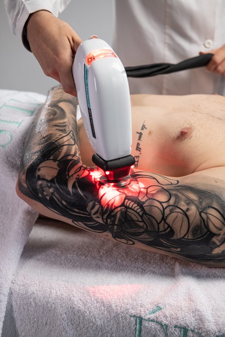 in foto la tecnologia epilis dedicata alla potenza del laser e alla epilazione progressiva permanente
