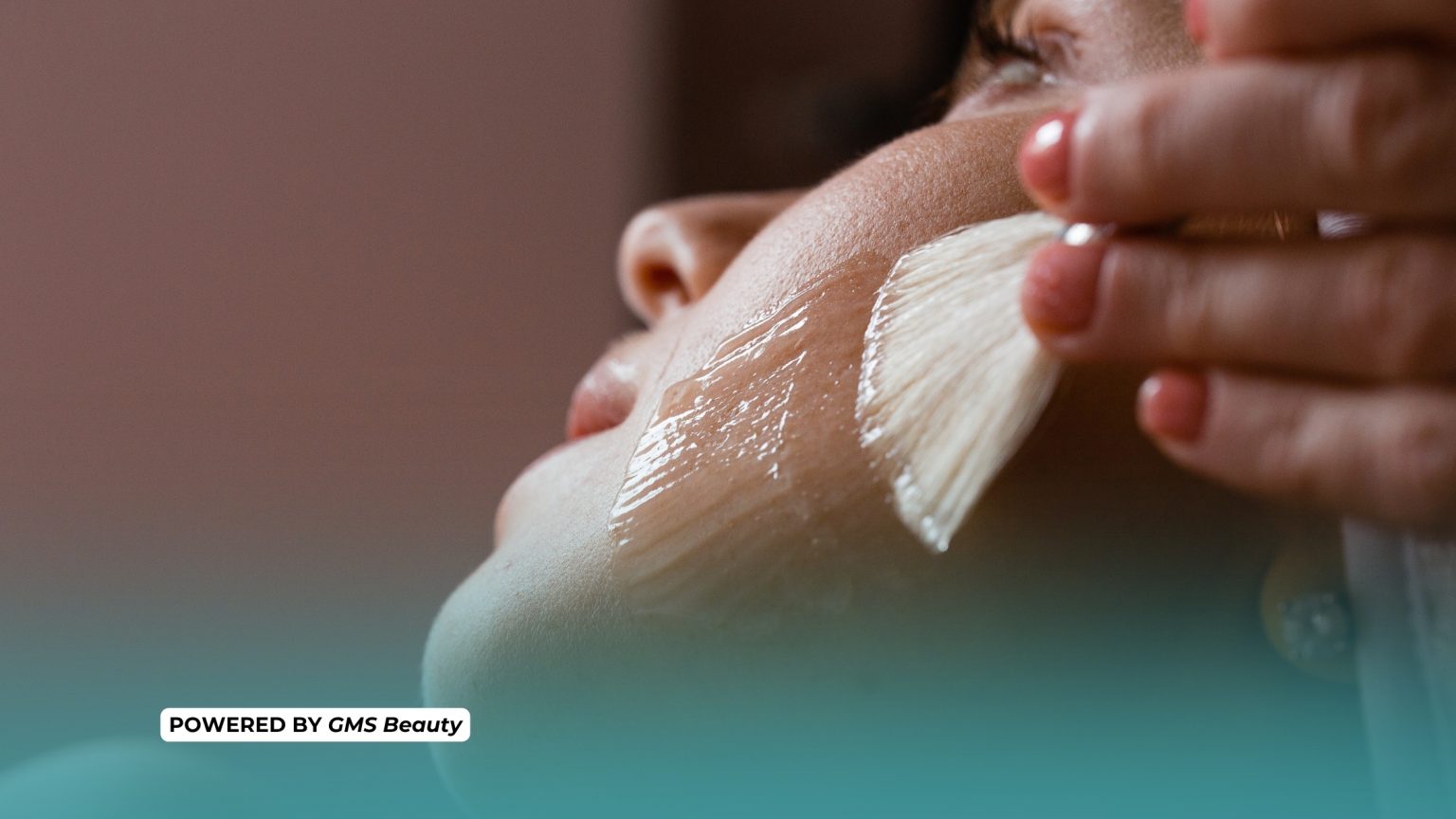 in foto una donna con del peeling chimico sulle guance