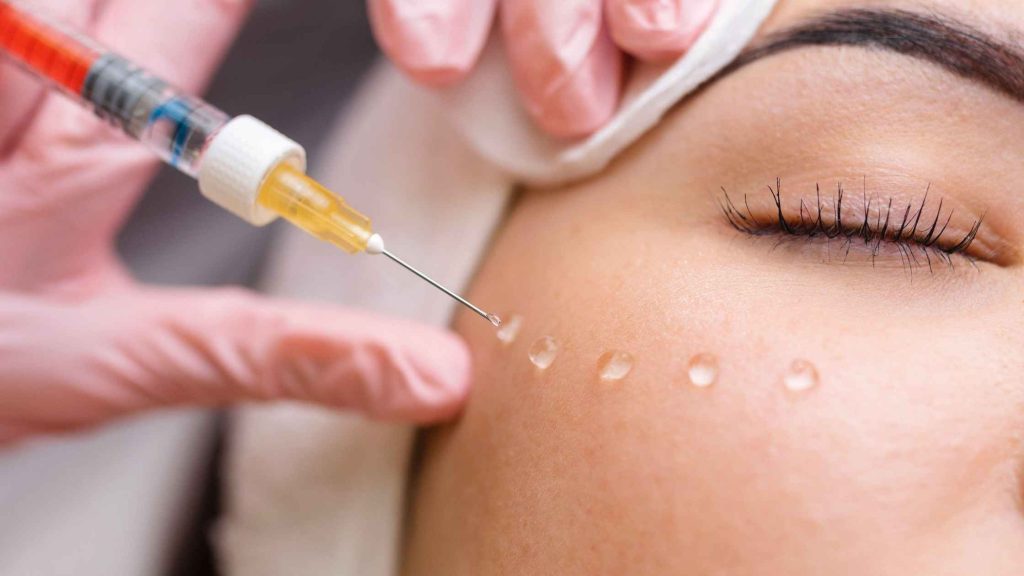 in foto una donna che si sottopone al trattamento filler