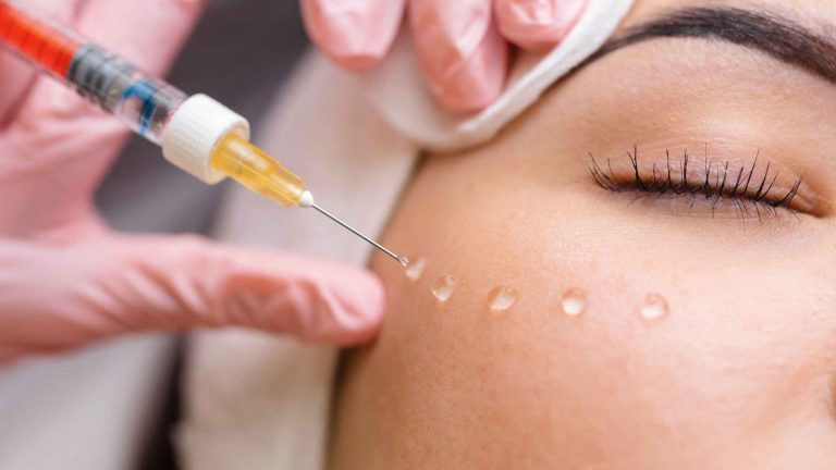 in foto una donna che si sottopone al trattamento filler